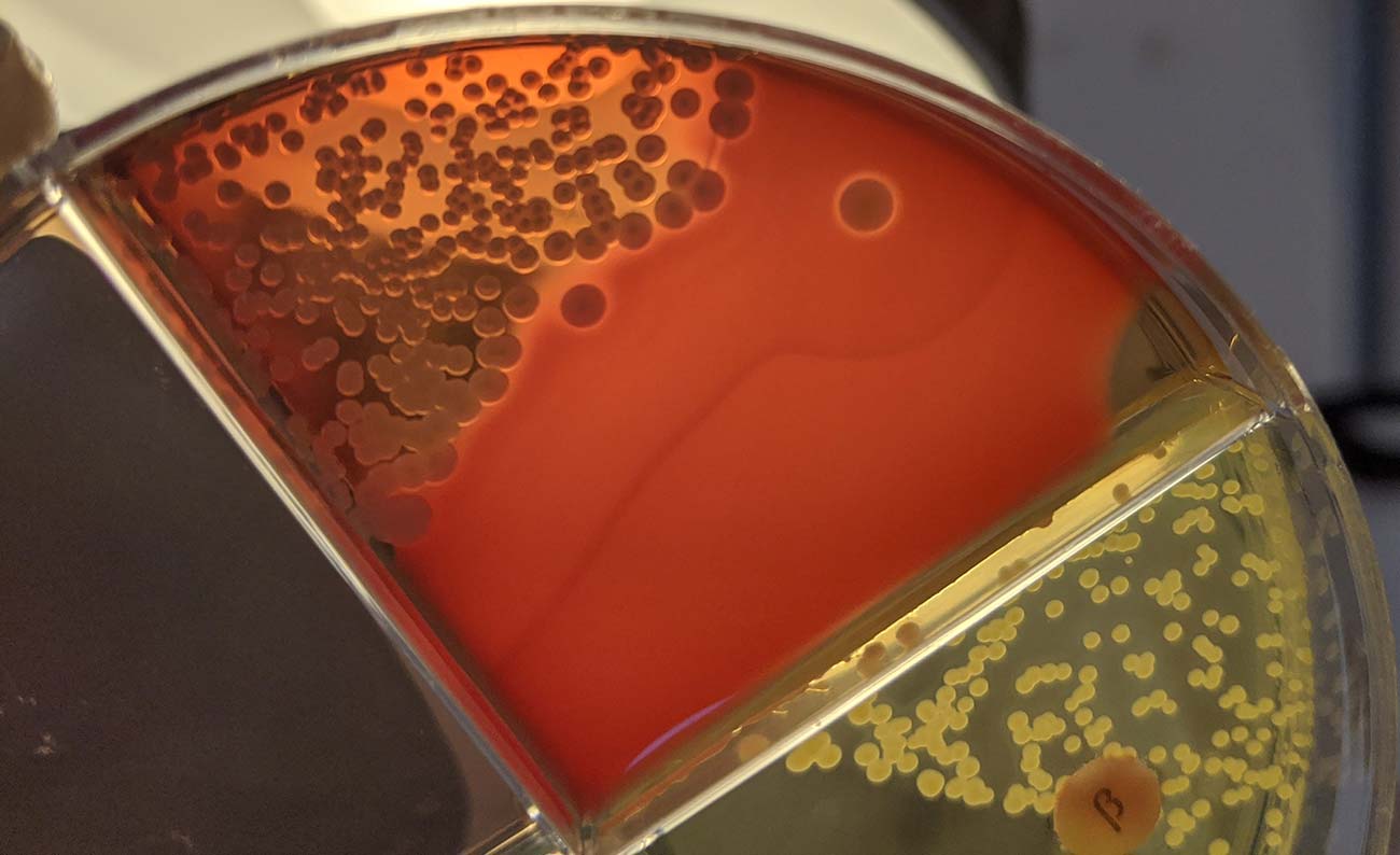 Bakterien Staphylococcus aureus är en av de vanligaste orsakerna till juverhälsoproblem och ses här när den växer på en blodagarplatta.